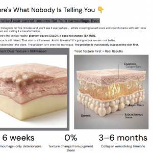 The truth about raised scars & stretch marks — The Markless Academy Manual